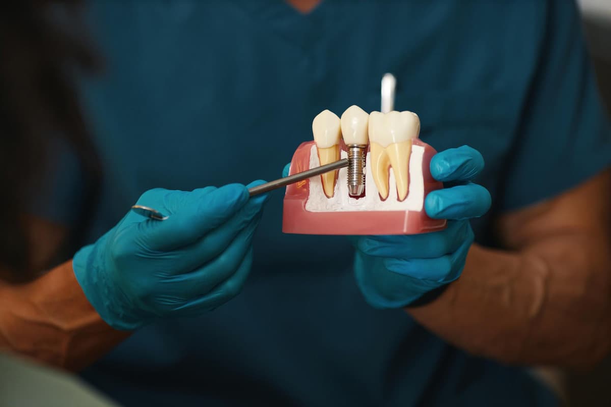 Dental professional demonstrating a dental implant model, highlighting advanced implant dentistry techniques for permanent tooth replacement.