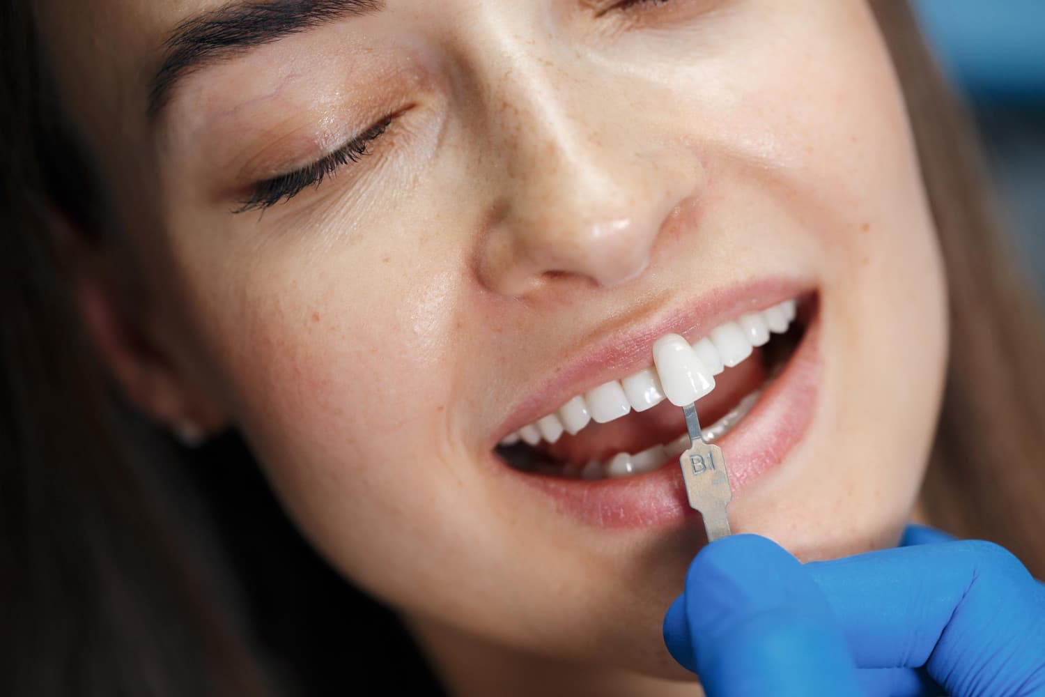 Close-up of a woman smiling, showcasing bright white teeth and a flawless complexion, highlighting the transformative effects of porcelain veneers for a confident smile.