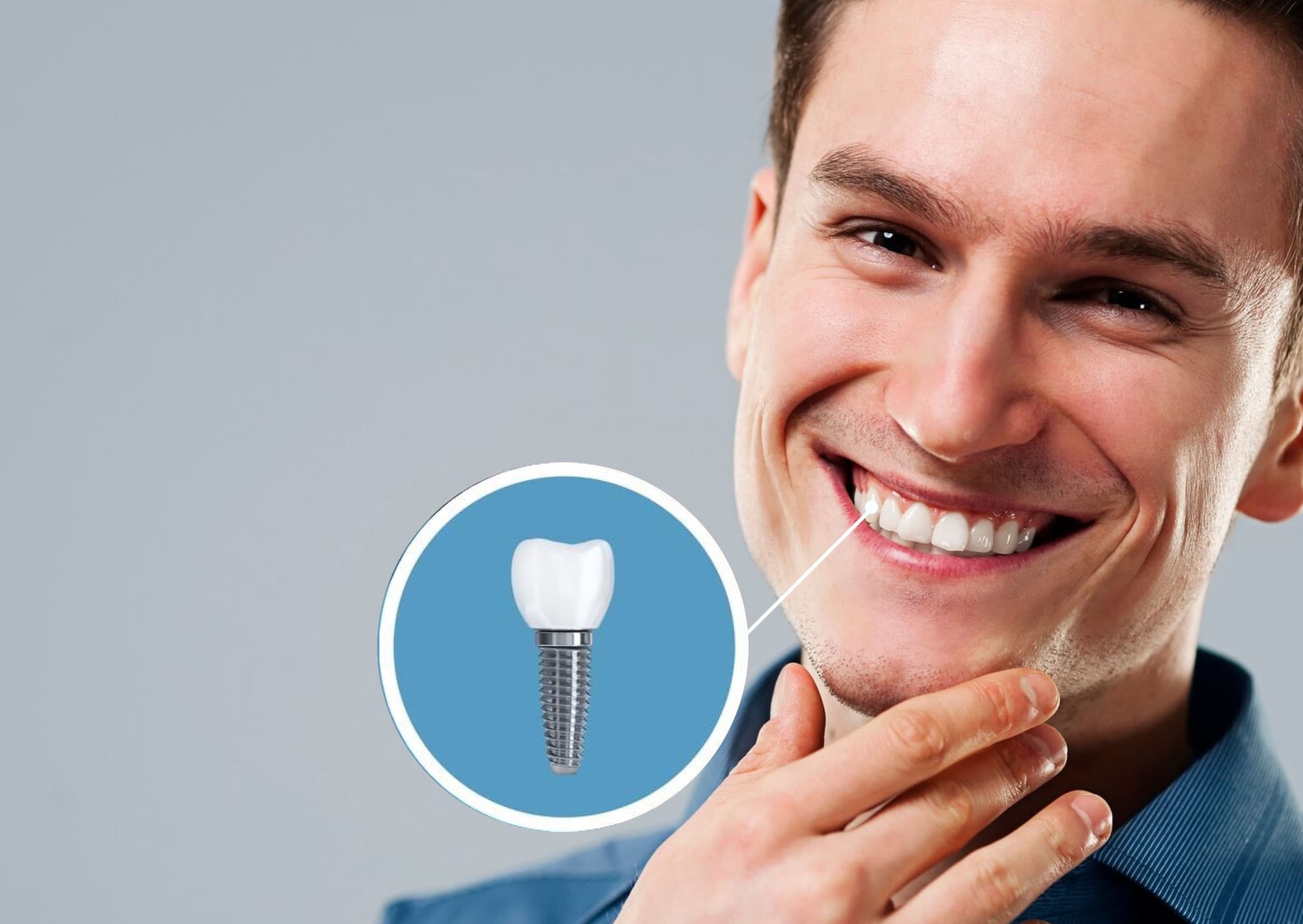 Man smiling, showcasing a dental implant with a close-up illustration of the titanium post and crown, highlighting restorative dental solutions.